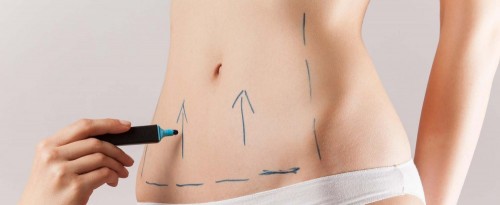 Metas estéticas fundamentales en la Abdominoplastía