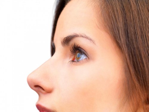 Rinoplastia: De lo simple a lo laborioso